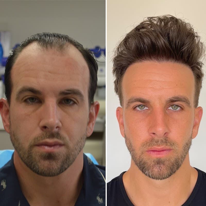 LA FUE Hair Clinic - Los Angeles FUE Hair Transplant Clinic clinic photo