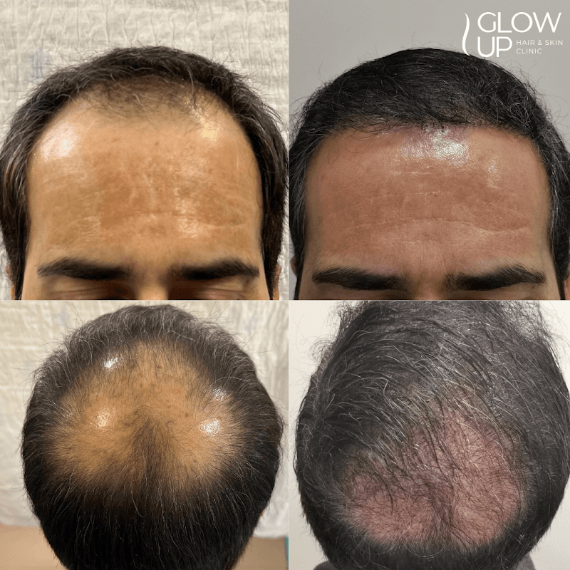 Glow Up Clinic