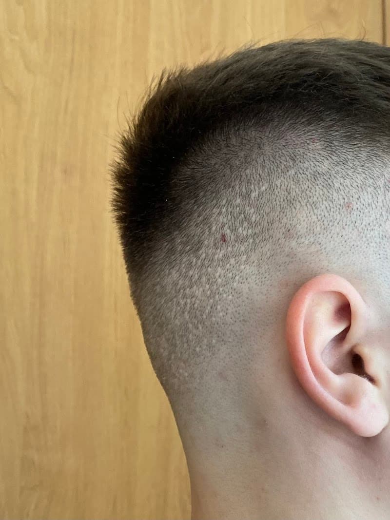 Clinical Hair&Health Robotická transplantace vlasů