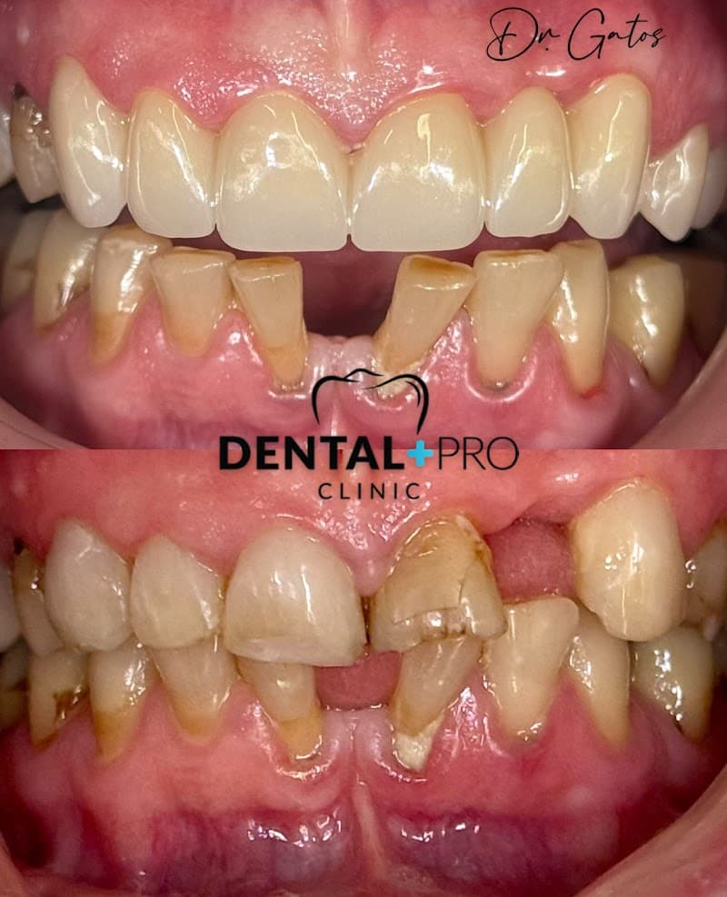 Dental Pro Clinic Athens