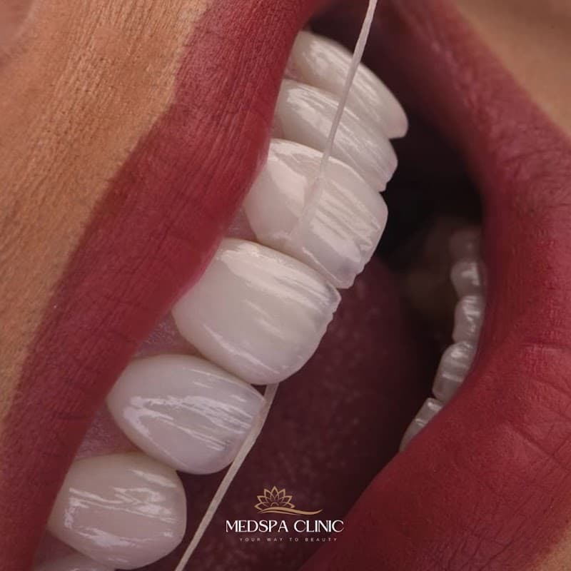Medspa Clinic - Dental Implants, Hollywood smile, Dental clinic in Turkey clinic photo