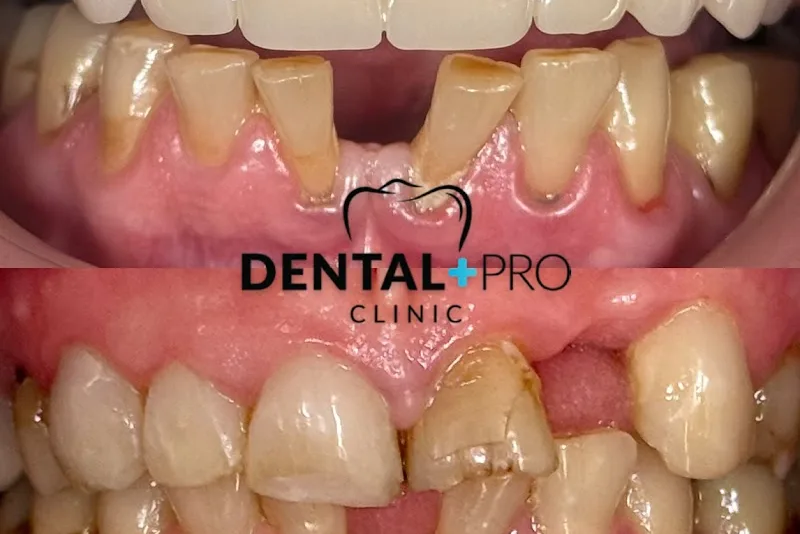 Dental Pro Clinic Athens