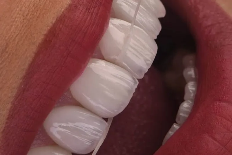 Medspa Clinic - Dental Implants, Hollywood smile, Dental clinic in Turkey