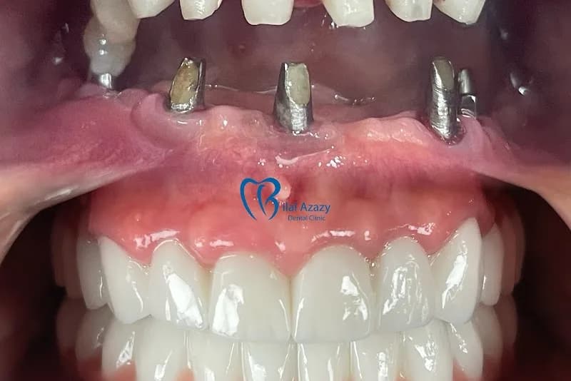 Dental Royal Clinic